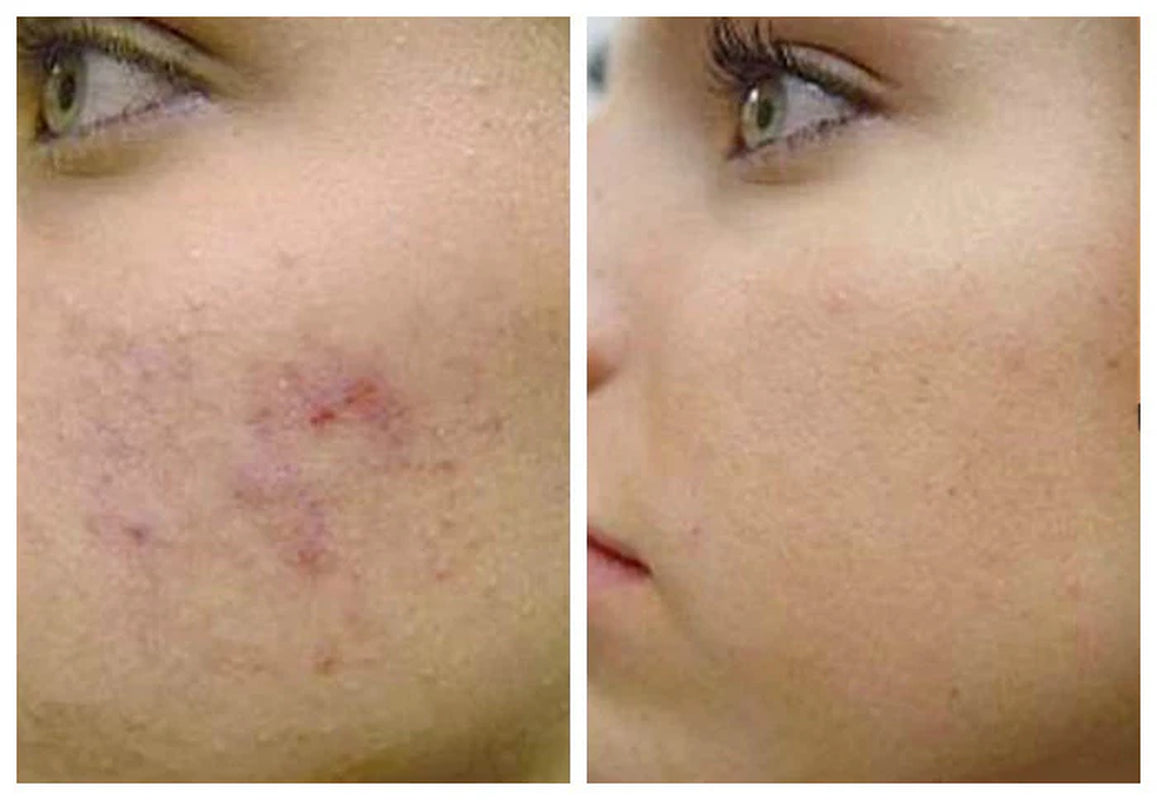 Retinol Anti-Aging Gel (20 G)